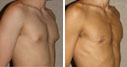Before & After Photos